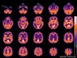 Cerebro